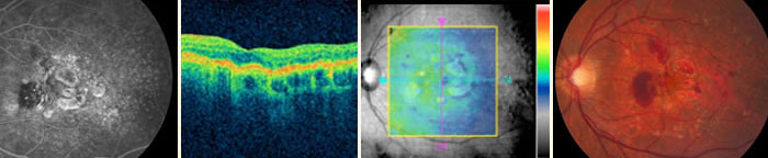 Four retinal images